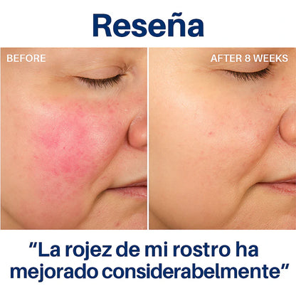 HYDROLUXE™ - Elimina el cloro y la cal de tu ducha.